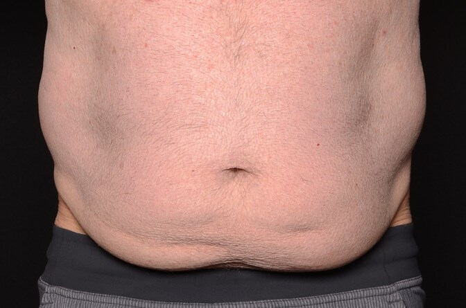 Before Image