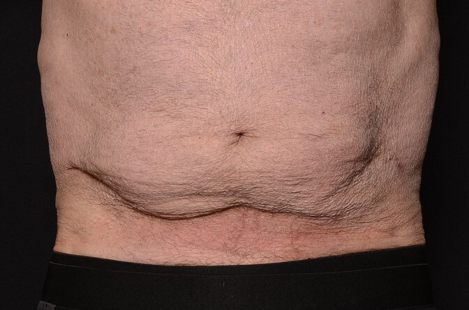 After Image