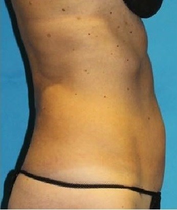 After Image