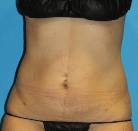 After Image