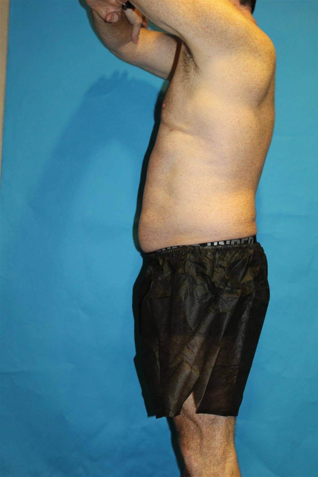 After Image